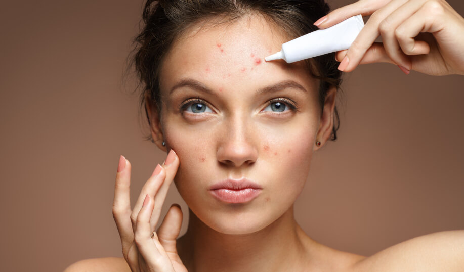 How The Acne Scars Are Treated