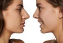 Reduce Nose Fat