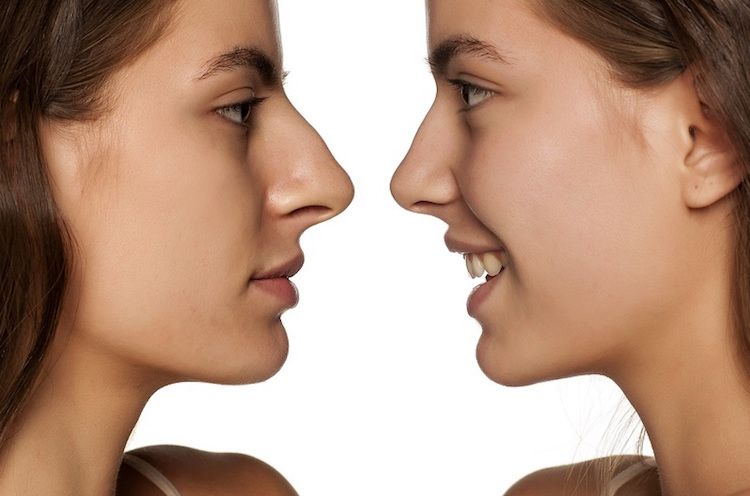 Reduce Nose Fat